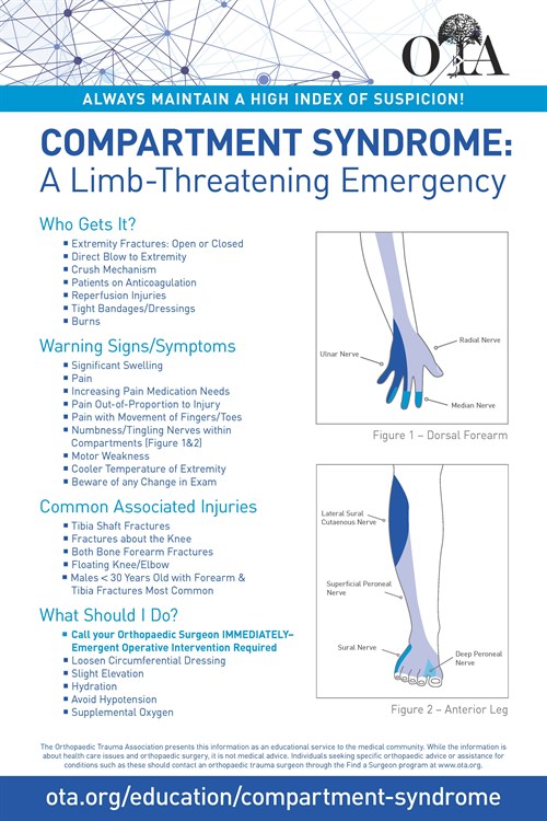 OTA Poster on Compartment Syndrome