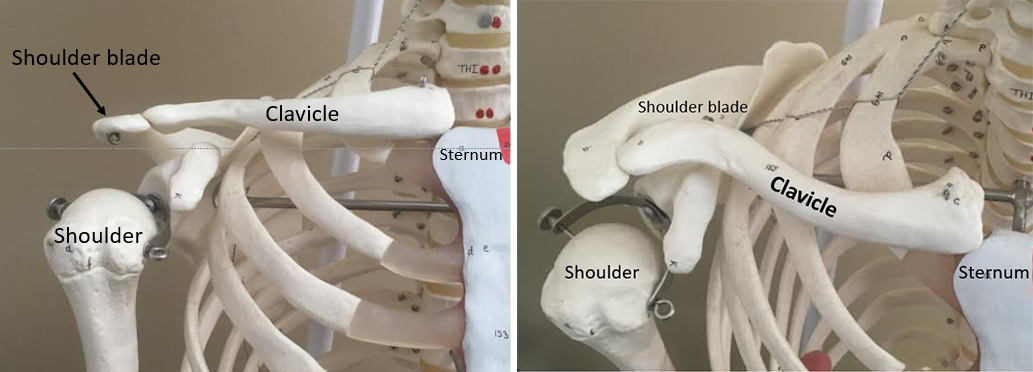 Patient Education - Clavicle Fractures (Broken Collarbone) TEST