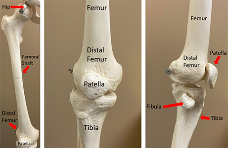 Views of the femur and the distal femur from the front as well as from the side