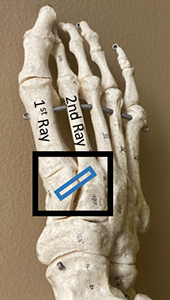 This is a model showing the top of the foot