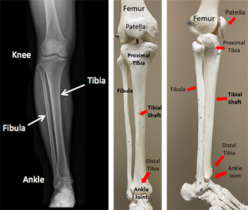 Tibia Or Not Tibia: How Body Parts Got Their Names : Shots - Health News :  NPR