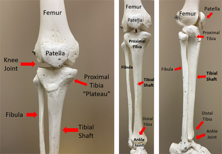Skeleton model showing the knee joint.