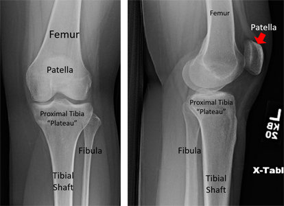 X-rays of the knee.