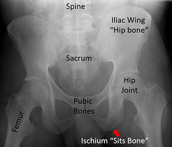 X-ray of the pelvis.