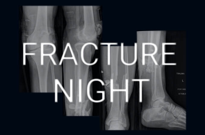 fracture night graphic