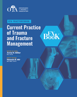 Photo of FractureBook cover