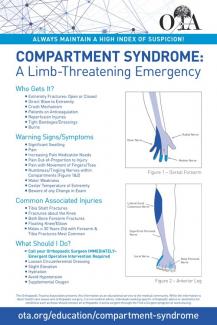 OTA Poster on Compartment Syndrome