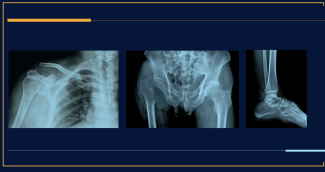 This graphic depicts a variety of 3 fractures to promote the 2025 Spring Residents Course