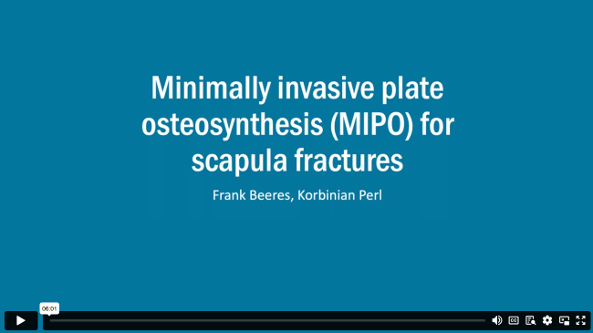 Minimally Invasive Plate Osteosynthesis for Scapula Fractures