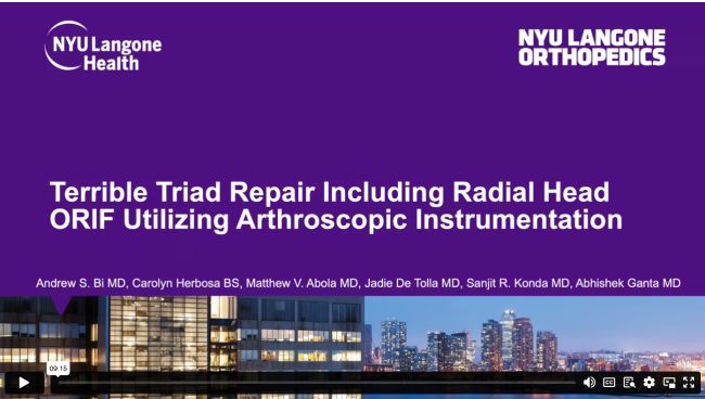 Terrible Triad Repair Including Radial Head ORIF Utilizing Arthroscopic Instrumentation