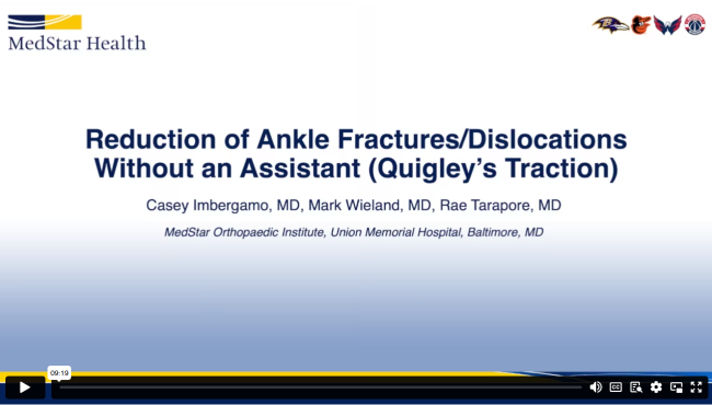 Reduction of Ankle Fractures/Dislocations Without an Assistant (Quigley’s Traction)