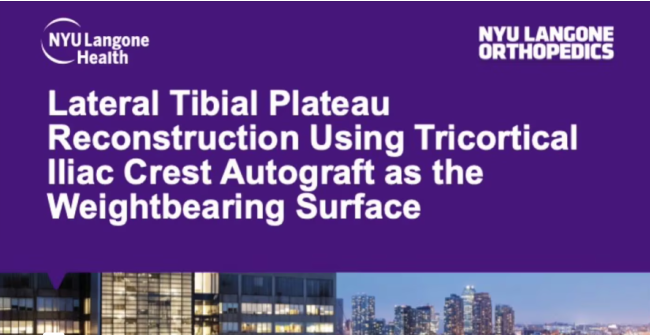 Lateral Tibial Plateau Reconstruction Using Tricortical Iliac Crest Autograft as the Weightbearing Surface