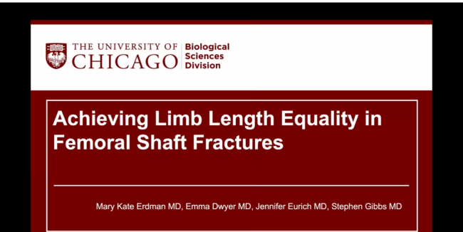 Achieving Limb Length Equality in Femoral Shaft Fractures